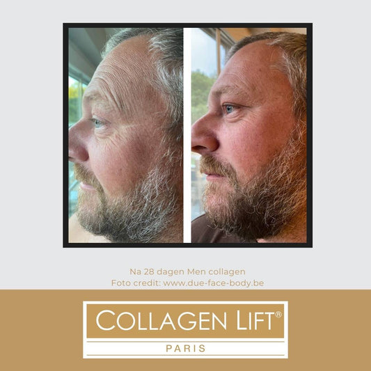 Men collageen verbetert de huid van mannen - Collagen Lift Benelux